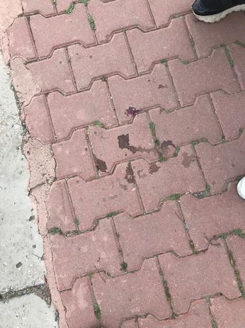 Kan kaybından öldüğü söylenen Yaren'in vurulduğu yerdeki kan.