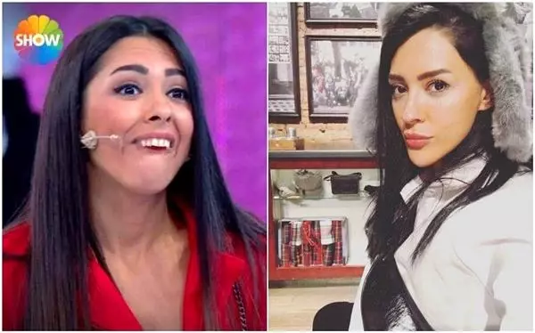 İşte Benim Stilim'in yıldızı estetikle bambaşka biri oldu